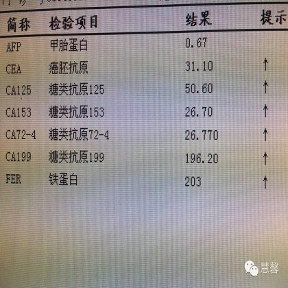 低级别黏液性肿瘤转移到卵巢伴腹腔假黏液瘤形成【小车】分享；【刘从容】老师讲解