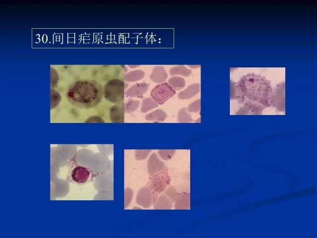 收藏！寄生虫图谱大全