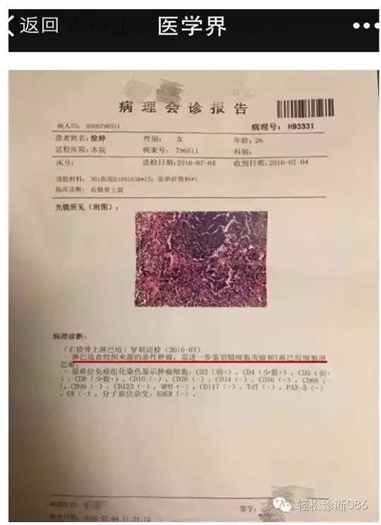 徐婷，你到底得的啥病？——从演员徐婷的病情谈病理报告的解读