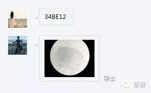 前列腺腺癌？（芳分享病例，华夏泌尿群讨论，孔祥田老师讲解）