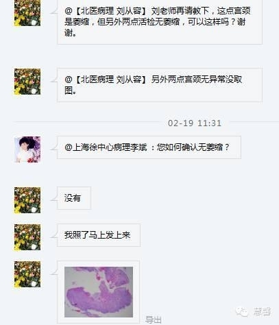 宫颈萎缩及其相关问题（李斌分享，刘从容老师讲解）