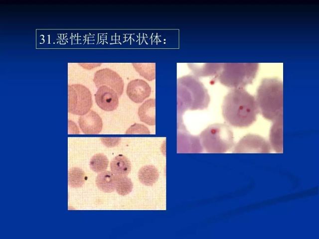 收藏！寄生虫图谱大全