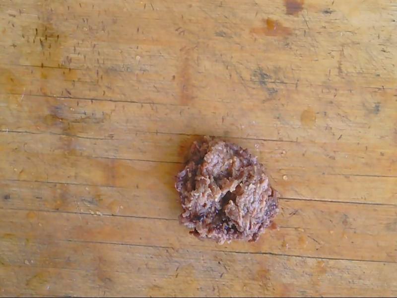 是大汗腺癌还是甲状腺癌转移？