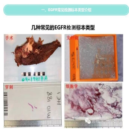 EGFR基因突变检测--基础篇