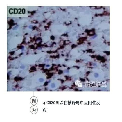 101诊断线索 笔记