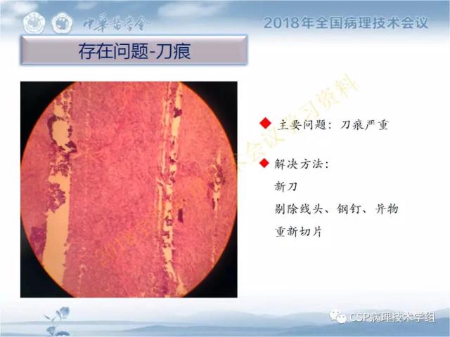 宋欣：HE切片质量控制及常见问题分析