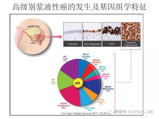 卵巢癌的病理诊断新进展（一）
