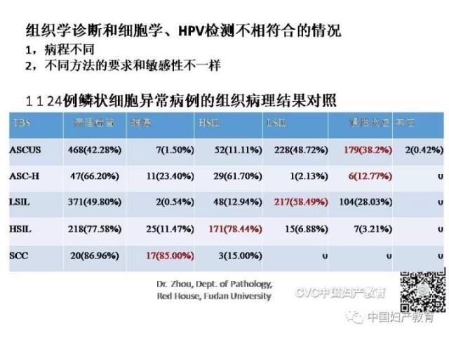 独家专访国内妇产科病理大咖周先荣教授：子宫颈上皮内病变及相关临床情况的若干病理学问题（一）