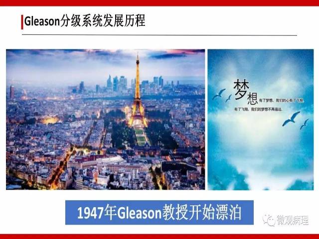 前列腺癌Gleason分级系统的前世今生