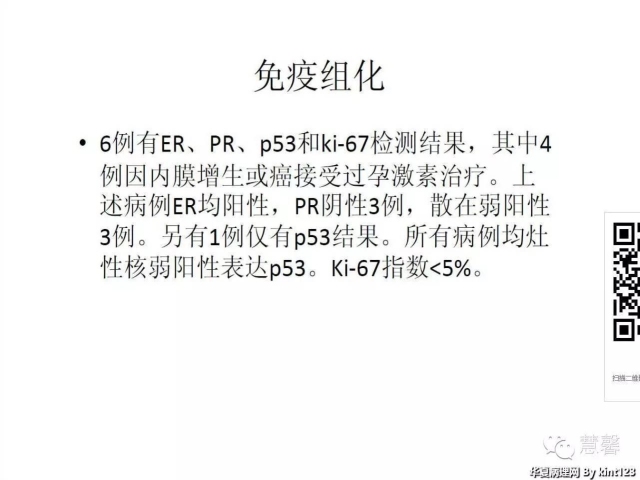子宫内膜乳头状增生（甜甜分享病例，孔祥田(Max)*Roswell*老师讲解，kent翻译整理文献）