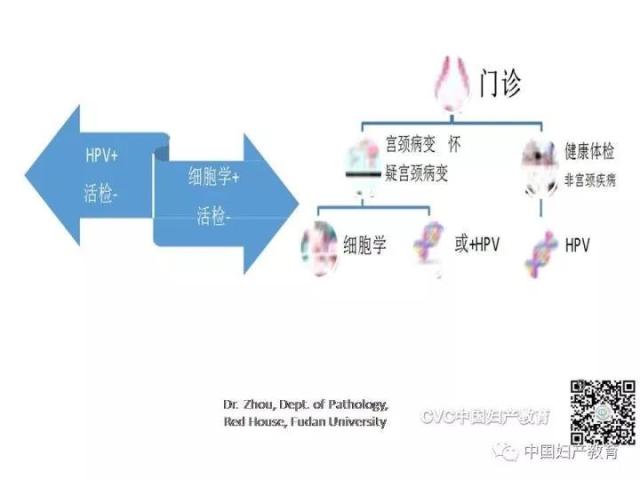 独家专访国内妇产科病理大咖周先荣教授：子宫颈上皮内病变及相关临床情况的若干病理学问题（一）