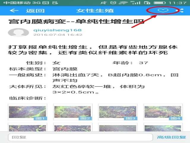 APP病例讨论KO微信学术群，华夏病理APP独家放送