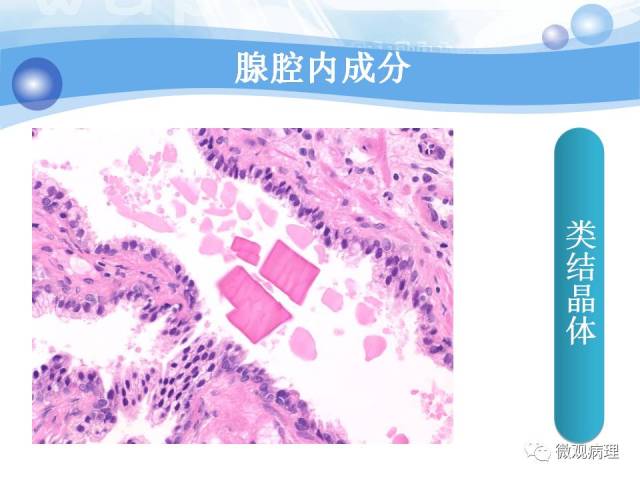 正常前列腺组织学
