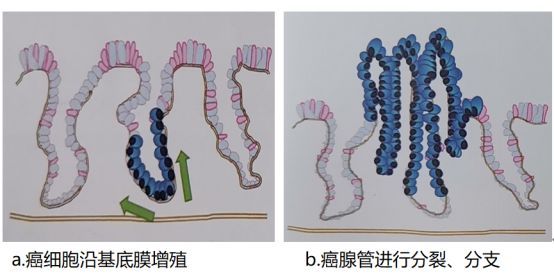 弄清这12个问题，成为早癌高手！