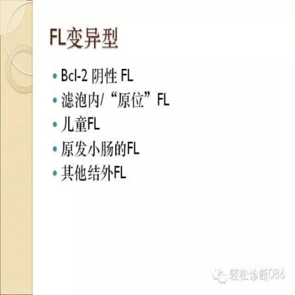 滤泡性淋巴瘤