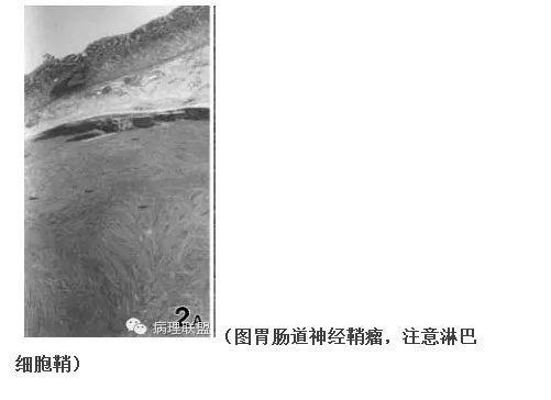 101诊断线索 笔记