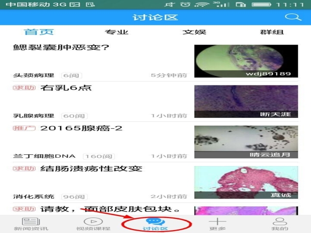 APP病例讨论KO微信学术群，华夏病理APP独家放送