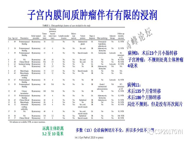 妇科肿瘤病理新进展——子宫间叶肿瘤进展