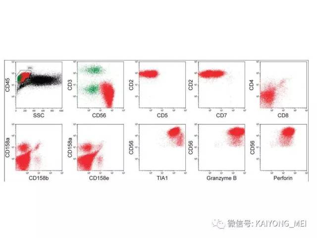 T细胞淋巴瘤病理诊断及进展（三）
