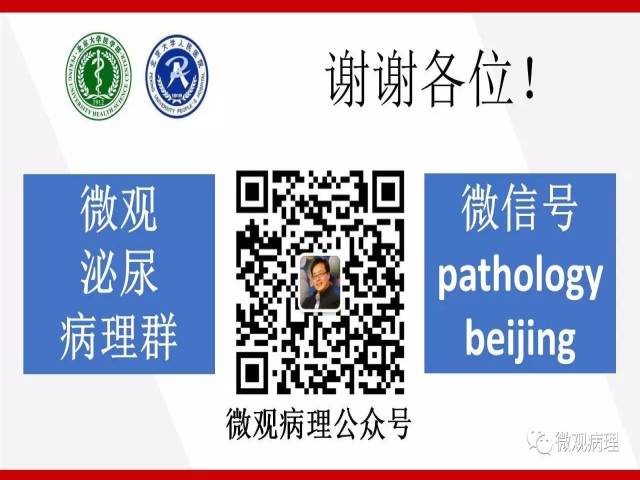 前列腺癌Gleason分级系统的前世今生