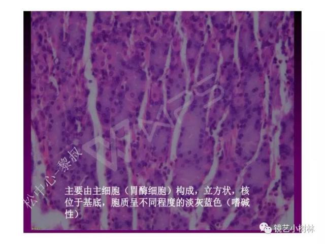 上消化道早癌病理的学习心得体会（附胃牵手癌的病例特点文献学习）