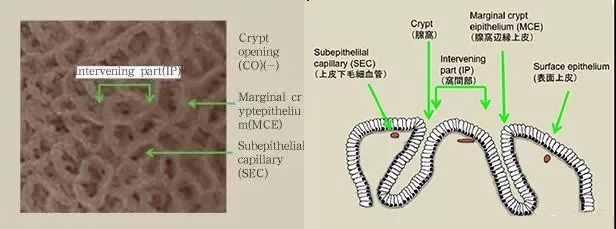 胃癌病理基础知识大盘点 胃癌病理基础知识大盘点