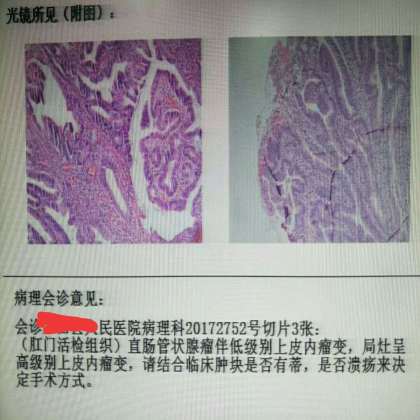 精准的病理诊断，才有精准的治疗