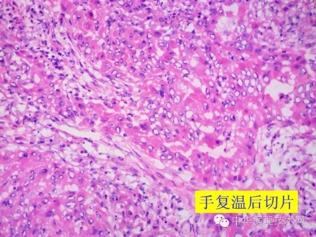 冰冻切片报告注意事项