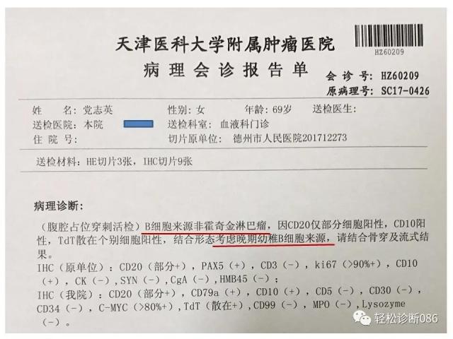 淋巴母细胞淋巴瘤