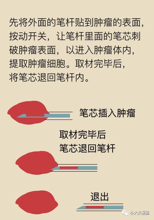 穿刺确诊癌症，这种方法会造成癌细胞扩散吗？