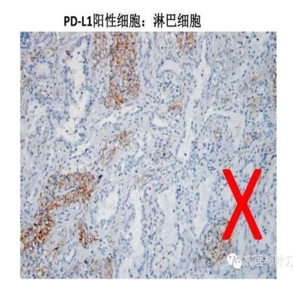 肿瘤精确医疗与分子病理检测