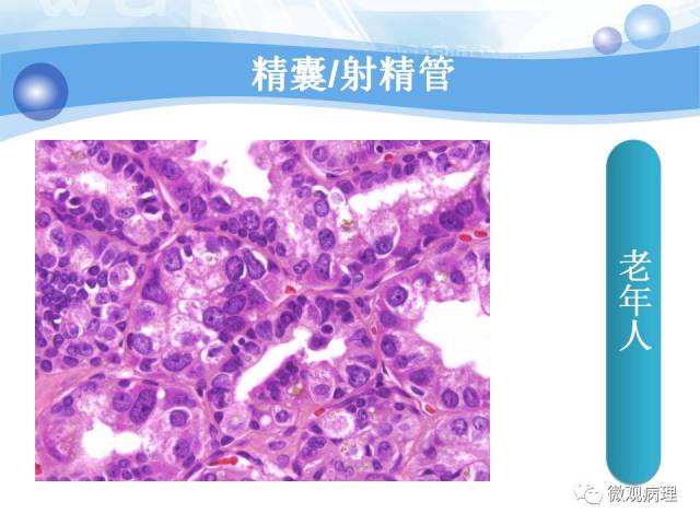 正常前列腺组织学