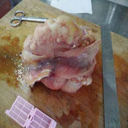 病理科工作札记（二十）小肠系膜脉管囊肿