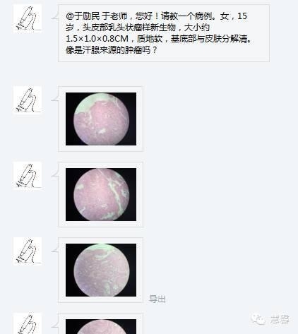 乳头状汗管囊腺瘤诊断及取材相关问题（迟悟分享，孔祥田及于励民老师讲解）