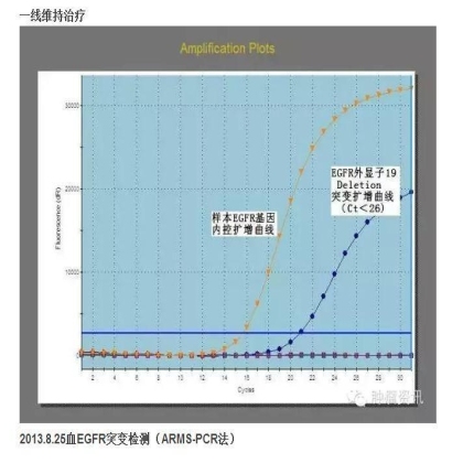 中日韩个体化诊疗案例大赛经典赏析之十三——组织活检突变阴性，血液检测EGFR19DEL,TKI 治疗PFS9个月