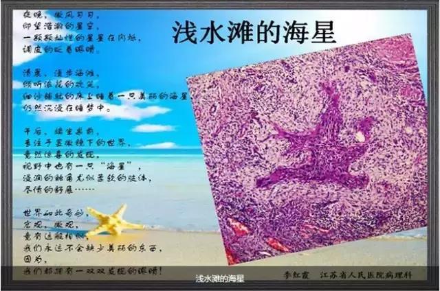 你见过这么美的病理切片吗？