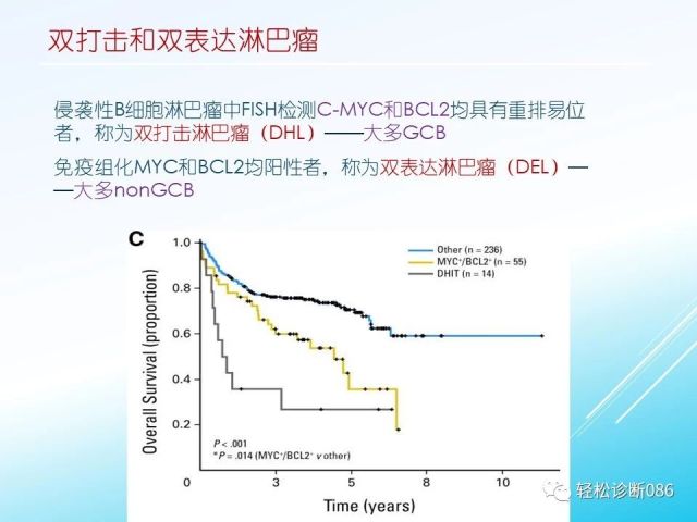 中枢神经系统弥漫大B细胞淋巴瘤