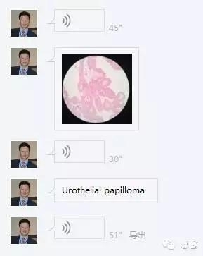 尿路上皮乳头状瘤、低级别尿路上皮乳头状癌的诊断及鉴别诊断，再听孔祥田(Max)*Roswell*NM老师讲解