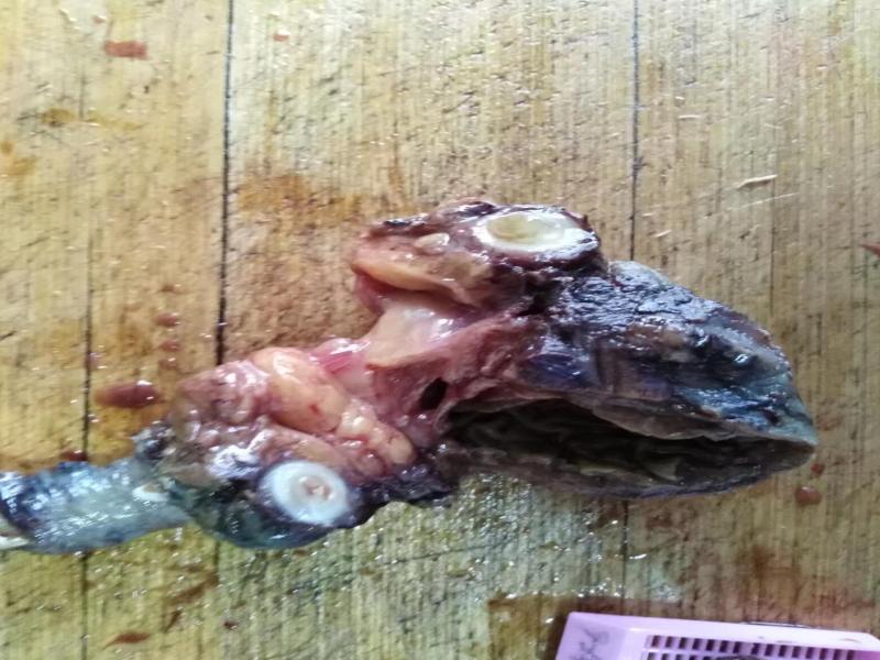 阑尾低级别粘液性肿瘤的坑（札记七十三）