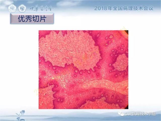 宋欣：HE切片质量控制及常见问题分析