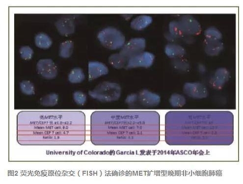 原发MET基因扩增型肿瘤“METoma”与精准医学