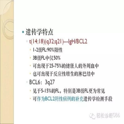 滤泡性淋巴瘤
