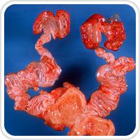 Webpathology.com-镜像翻译（自学使用，版权归原网站所有）