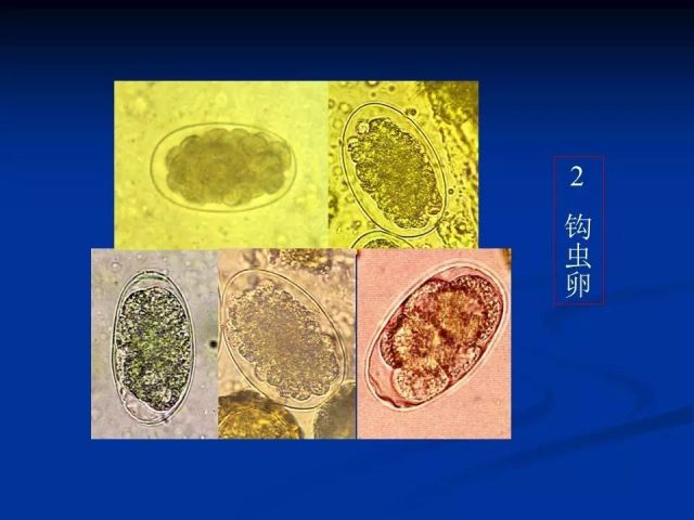 收藏！寄生虫图谱大全