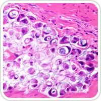 Webpathology.com-镜像翻译（自学使用，版权归原网站所有）