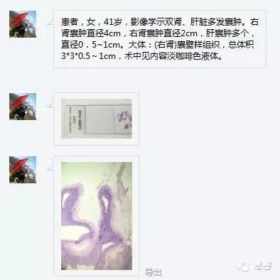 囊性肾瘤（杨倩分享，王哲老师等讲解及讨论）