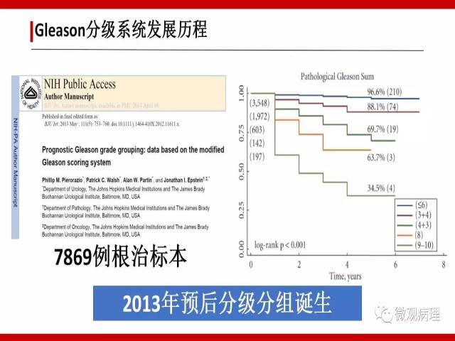前列腺癌Gleason分级系统的前世今生