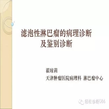 滤泡性淋巴瘤