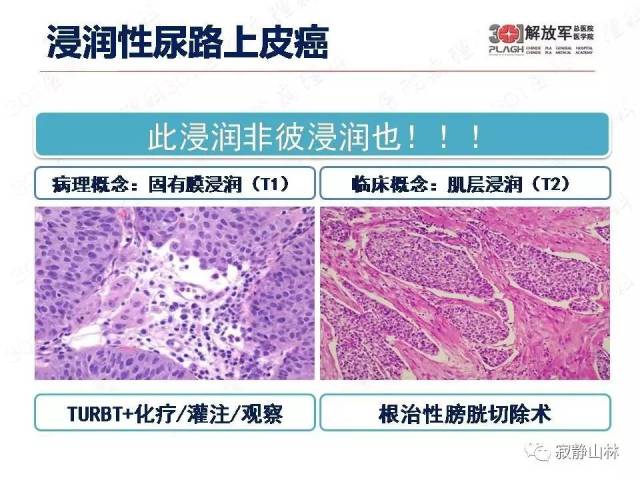 泌尿系统常见肿瘤标本病理报告规范