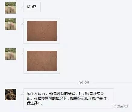 低分化支持－间质细胞瘤（ 戴敏病例分享，群友讨论，刘从容老师讲解）